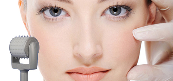 dermaroller-facial-treatment-1-.jpg