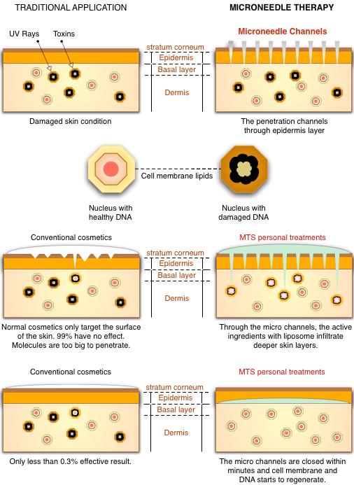 traditional-application-vs-mts traditional-application-vs-mts